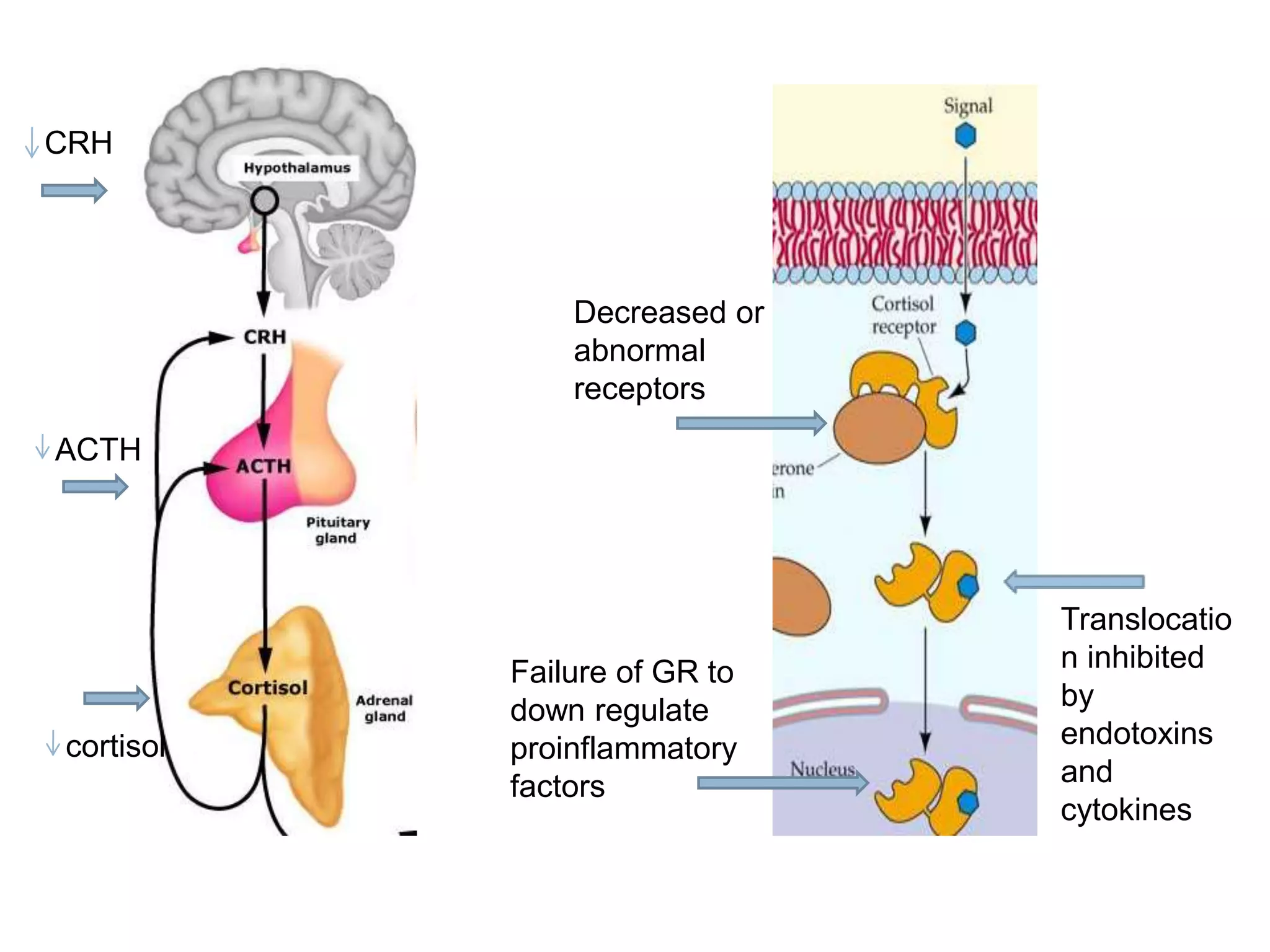 Translocatio
n inhibited
by
endotoxins
and
cytokines
Decreased or
abnormal
receptors
Failure of GR to
down regulate
proinflammatory
factors
CRH
ACTH
cortisol
 