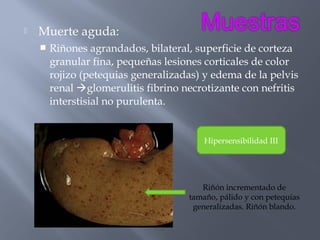 

Muerte aguda:


Riñones agrandados, bilateral, superficie de corteza
granular fina, pequeñas lesiones corticales de color
rojizo (petequias generalizadas) y edema de la pelvis
renal glomerulitis fibrino necrotizante con nefritis
interstisial no purulenta.

Hipersensibilidad III

Riñón incrementado de
tamaño, pálido y con petequias
generalizadas. Riñón blando.

 