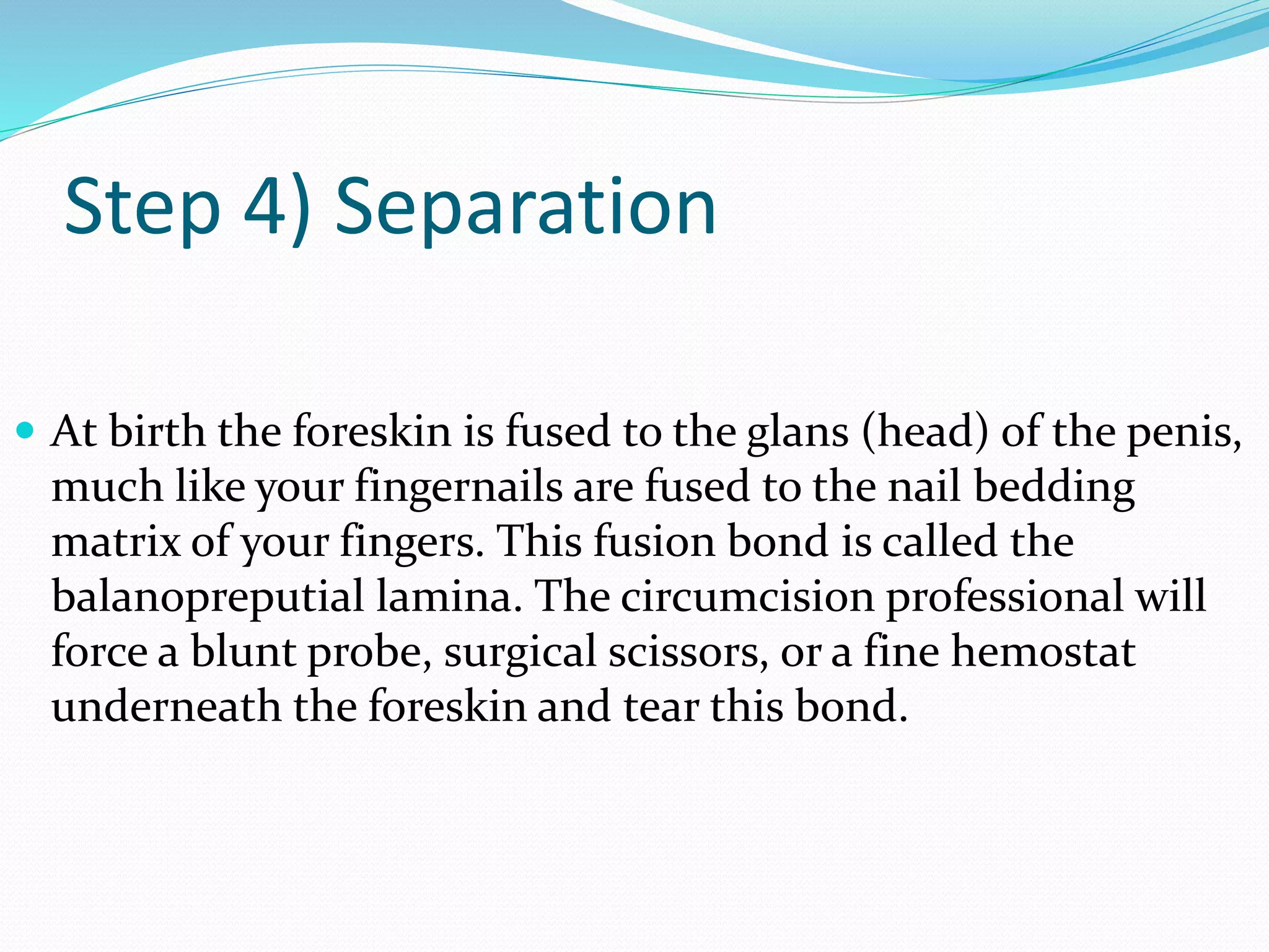 Step 4) Separation 
 At birth the foreskin is fused to the glans (head) of the penis, 
much like your fingernails are fused to the nail bedding 
matrix of your fingers. This fusion bond is called the 
balanopreputial lamina. The circumcision professional will 
force a blunt probe, surgical scissors, or a fine hemostat 
underneath the foreskin and tear this bond. 
 