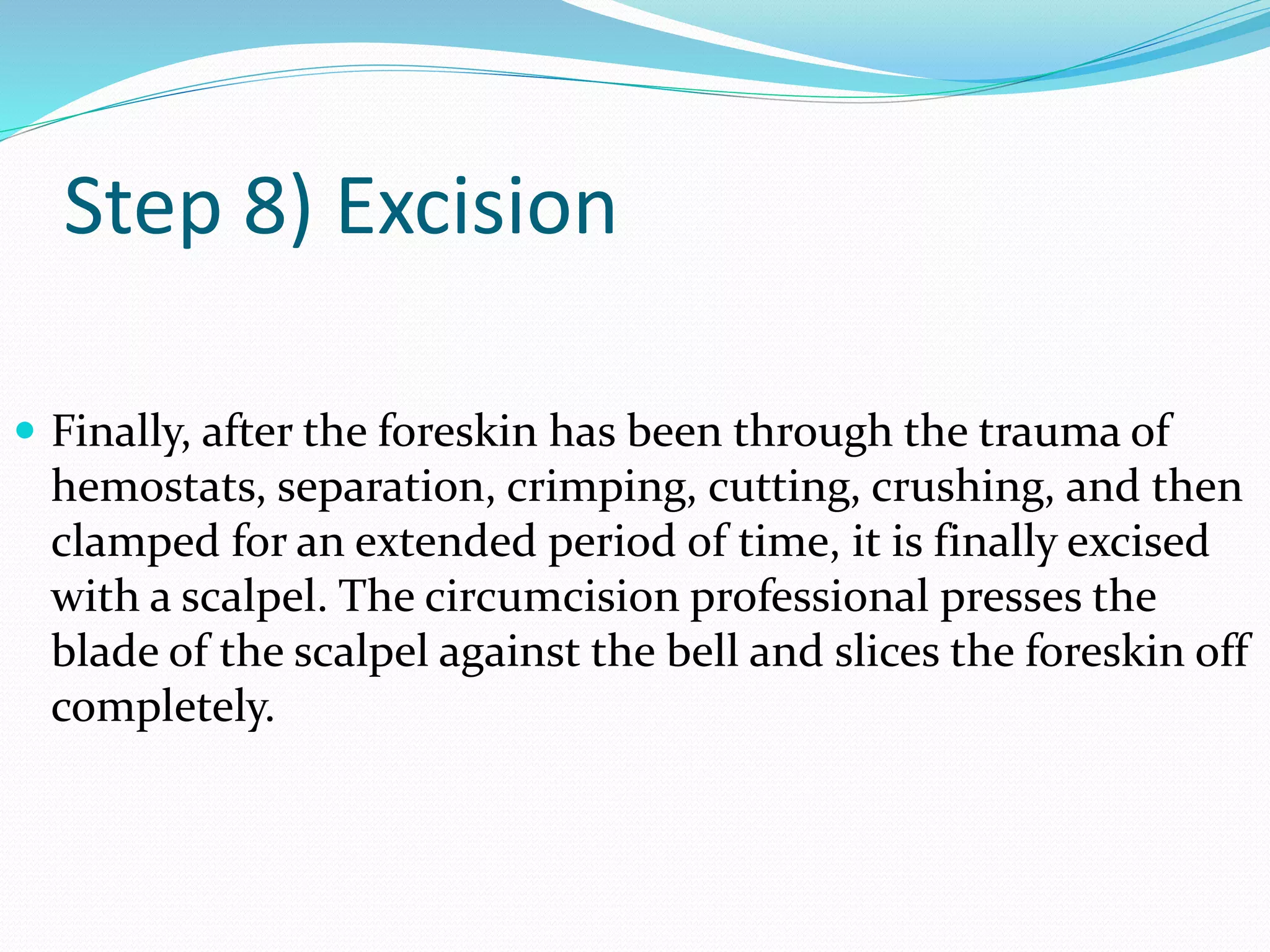 Step 8) Excision 
 Finally, after the foreskin has been through the trauma of 
hemostats, separation, crimping, cutting, crushing, and then 
clamped for an extended period of time, it is finally excised 
with a scalpel. The circumcision professional presses the 
blade of the scalpel against the bell and slices the foreskin off 
completely. 
 