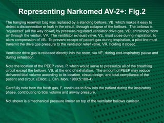Representing Narkomed AV-2+: Fig.2
The hanging reservoir bag was replaced by a standing bellows, VB, which makes it easy to
detect a disconnection or leak in the circuit, through collapse of the bellows. The bellows is
“squeezed” (all the way down!) by pressure-regulated ventilator drive gas, VD, entraining room
air through the venturi, VV. The ventilator exhaust valve, VE, must close during inspiration, to
allow compression of VB. To prevent escape of patient gas during inspiration, a pilot line must
transmit the drive gas pressure to the ventilator relief valve, VR, holding it closed.
Ventilator drive gas is released directly into the room, via VE, during end-inspiratory pause and
during exhalation.
Note the location of the PEEP valve, P, which would serve to pressurize all of the breathing
circuit except the bellows, VB, at the end of exhalation. The amount of PEEP may reduce
delivered tidal volume according to its location, circuit design, and total compliance of the
patient and circuit. (Elliott. J. Clin. Mon. 1989;5:100-4)
Carefully note how the fresh gas, F, continues to flow into the patient during the inspiratory
phase, contributing to tidal volume and airway pressure.
Not shown is a mechanical pressure limiter on top of the ventilator bellows canister.
 