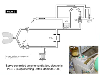 Servo-controlled volume ventilation, electronic
PEEP. (Representing Datex-Ohmeda 7900)
 