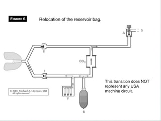 Relocation of the reservoir bag.
This transition does NOT
represent any USA
machine circuit.
FIGURE 6
 