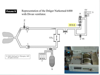 Representation of the Dräger Narkomed 6400
with Divan ventilator. A
M/S-E
FIGURE 9
 