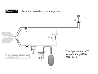 This figure does NOT
represent any USA-
FDA circuit.
New location of a ventilator piston.
FIGURE 10
 