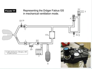 Representing the Dräger Fabius GS
in mechanical ventilation mode.
FIGURE 11
 