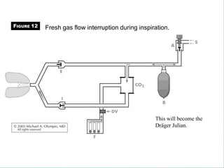 Fresh gas flow interruption during inspiration.
This will become the
Dräger Julian.
FIGURE 12
 