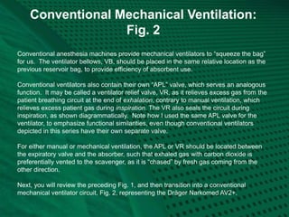 Conventional Mechanical Ventilation:
Fig. 2
Conventional anesthesia machines provide mechanical ventilators to “squeeze the bag”
for us. The ventilator bellows, VB, should be placed in the same relative location as the
previous reservoir bag, to provide efficiency of absorbent use.
Conventional ventilators also contain their own “APL” valve, which serves an analogous
function. It may be called a ventilator relief valve, VR, as it relieves excess gas from the
patient breathing circuit at the end of exhalation, contrary to manual ventilation, which
relieves excess patient gas during inspiration. The VR also seals the circuit during
inspiration, as shown diagrammatically. Note how I used the same APL valve for the
ventilator, to emphasize functional similarities, even though conventional ventilators
depicted in this series have their own separate valve.
For either manual or mechanical ventilation, the APL or VR should be located between
the expiratory valve and the absorber, such that exhaled gas with carbon dioxide is
preferentially vented to the scavenger, as it is “chased” by fresh gas coming from the
other direction.
Next, you will review the preceding Fig. 1, and then transition into a conventional
mechanical ventilator circuit, Fig. 2, representing the Dräger Narkomed AV2+.
 