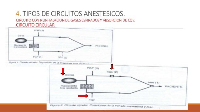 Circuitos anestesicos; sistema de administracion de anestesia