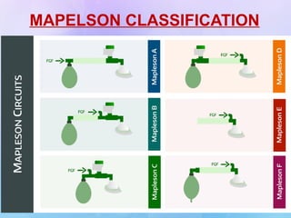 MAPELSON CLASSIFICATION
 