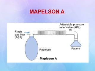 MAPELSON A
 