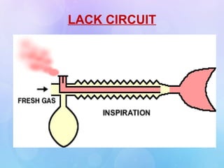LACK CIRCUIT
 