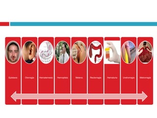 Epistaxis Otorragia Hematemesis Hemoptisis Melena Rectorragia Hematuria Uretrorragia Metrorragia
 