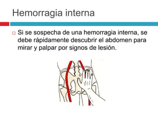 Hemorragia interna
 Si se sospecha de una hemorragia interna, se
debe rápidamente descubrir el abdomen para
mirar y palpar por signos de lesión.
 