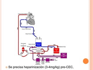 Circulaci n Extracorporea PPTX circulaci-n-extracorporea-pptx