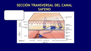 SECCIÓN TRANSVERSAL DEL CANAL
SAFENO
 