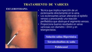 TRATAMIENTO DE VARICES
ESCLEROTERAPIA
• Técnica que implica inyección de un
esclerosante directamente en la vena.
• Los esclerosantes actúan alterando el epitelio
venoso y provocando una reacción
periflebitica que obstruye el segmento venoso.
• Proporciona buenos resultados en venas
varicosas con diametro <3mm y en
telangiectasias.
Solución salina Hipertónica
Tetradecilsulfato de sodio
Polidocanol
 