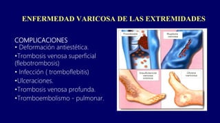 ENFERMEDAD VARICOSA DE LAS EXTREMIDADES
COMPLICACIONES
• Deformación antiestética.
•Trombosis venosa superficial
(flebotrombosis)
• Infección ( tromboflebitis)
•Ulceraciones.
•Trombosis venosa profunda.
•Tromboembolismo - pulmonar.
 