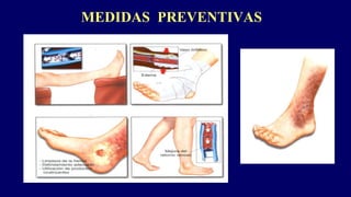 MEDIDAS PREVENTIVAS
 