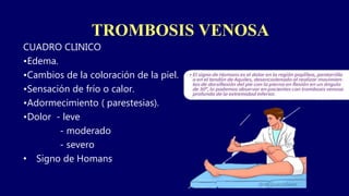 TROMBOSIS VENOSA
CUADRO CLINICO
•Edema.
•Cambios de la coloración de la piel.
•Sensación de frío o calor.
•Adormecimiento ( parestesias).
•Dolor - leve
- moderado
- severo
• Signo de Homans
 