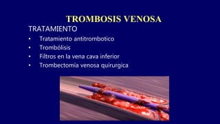TROMBOSIS VENOSA
TRATAMIENTO
• Tratamiento antitrombotico
• Trombólisis
• Filtros en la vena cava inferior
• Trombectomía venosa quirurgica
 