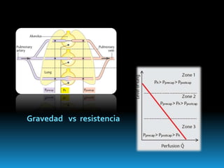 Resistencia   vascular  Pulmonar