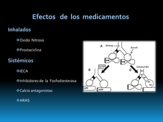 Presión intravascular