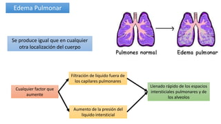 Se produce igual que en cualquier
otra localización del cuerpo
Cualquier factor que
aumente
Filtración de liquido fuera de
los capilares pulmonares
Aumento de la presión del
liquido intersticial
Llenado rápido de los espacios
intersticiales pulmonares y de
los alveolos
Edema Pulmonar
 