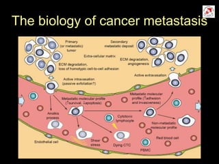 The biology of cancer metastasis
 