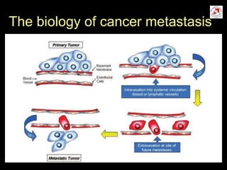 The biology of cancer metastasis
 