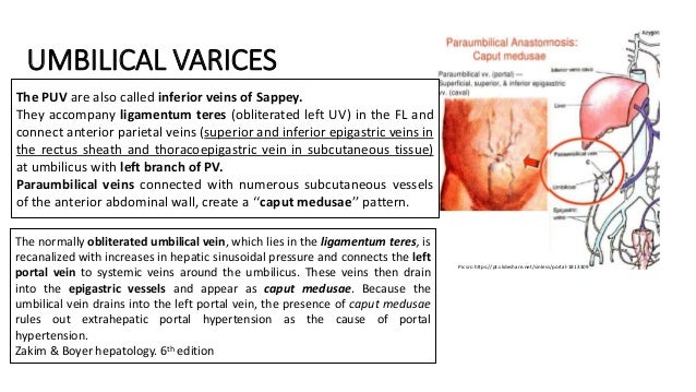 Circulation of liver & Portosystemic collaterals rectus sheath diagram 