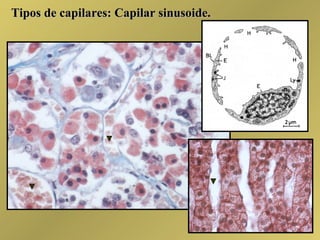 Tipos de capilares: Capilar sinusoide. 