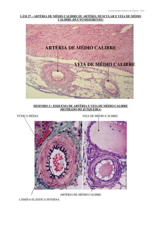 Universidade Federal do Ceará - UFC
LÂM 27 – ARTÉRIA DE MÉDIO CALIBRE OU ARTÉRIA MUSCULAR E VEIA DE MÉDIO
CALIBRE (DUCTO DEFERENTE)
ARTÉRIA DE MÉDIO CALIBRE
VEIA DE MÉDIO CALIBRE
DESENHO 3 – ESQUEMA DE ARTÉRIA E VEIA DE MÉDIO CALIBRE
(RETIRADO DO JUNQUEIRA)
TÚNICA MÉDIA VEIA DE MÉDIO CALIBRE
ARTÉRIA DE MÉDIO CALIBRE
LÂMINA ELÁSTICA INTERNA
 