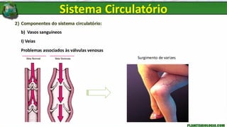 2) Componentes do sistema circulatório:
b) Vasos sanguíneos
I) Veias
Problemas associados às válvulas venosas
Sistema Circulatório
Surgimento de varizes
 