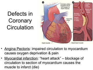 Defects in
Coronary
Circulation
• Angina Pectoris: impaired circulation to myocardium
causes oxygen deprivation & pain
• Myocardial infarction: “heart attack” – blockage of
circulation to section of myocardium causes the
muscle to infarct (die)
 