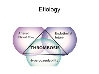 Etiology
 