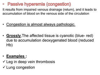It results from impaired venous drainage (return), and it leads to
accumulation of blood on the venous side of the circulation
• Congestion is almost always pathologic.
• Grossly,The affected tissue is cyanotic (blue- red)
due to accumulation deoxygenated blood (reduced
Hb)
• Examples :
 Leg in deep vein thrombosis
 Lung congestion
 