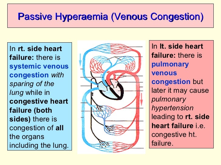 Circulatory disturbances