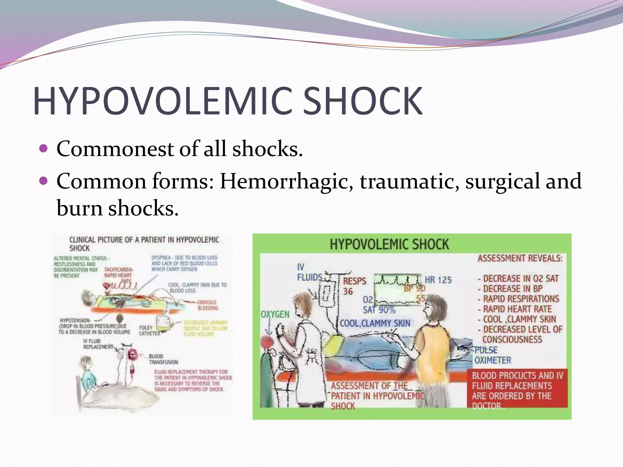 Circulatory shock | PPTX