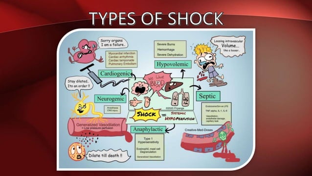 Circulatory shock Cardiogenic Shock Hypovolemic Shock Sepsis, Septic ...