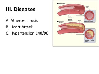 III. DiseasesA. AtherosclerosisB. Heart AttackC. Hypertension 140/90