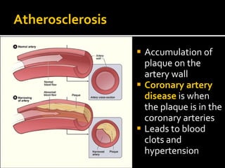 Atherosclerosis
 Accumulation of
plaque on the
artery wall
 Coronary artery
disease is when
the plaque is in the
coronary arteries
 Leads to blood
clots and
hypertension
 