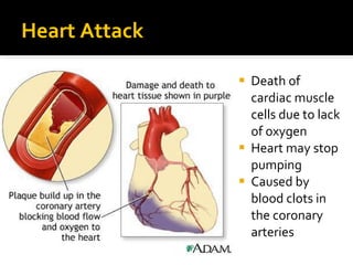 Heart Attack
 Death of
cardiac muscle
cells due to lack
of oxygen
 Heart may stop
pumping
 Caused by
blood clots in
the coronary
arteries
 