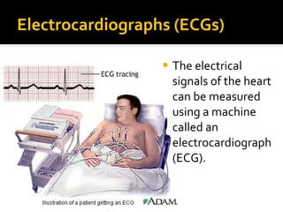 Electrocardiographs (ECGs)
 The electrical
signals of the heart
can be measured
using a machine
called an
electrocardiograph
(ECG).
 