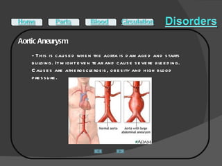 Aortic Aneurysm   - This is caused when the aorta is damaged and starts bulging. It might even tear and cause severe bleeding. Causes are atherosclerosis, obesity and high blood pressure.  