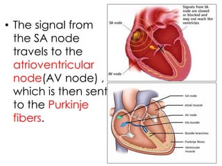 • The signal from
the SA node
travels to the
atrioventricular
node(AV node) ,
which is then sent
to the Purkinje
fibers.
 