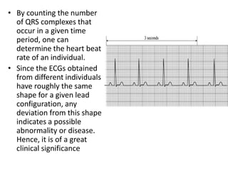 • By counting the number
of QRS complexes that
occur in a given time
period, one can
determine the heart beat
rate of an individual.
• Since the ECGs obtained
from different individuals
have roughly the same
shape for a given lead
configuration, any
deviation from this shape
indicates a possible
abnormality or disease.
Hence, it is of a great
clinical significance
 