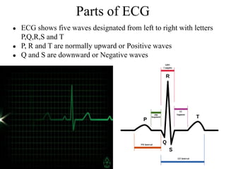 Parts of ECG
● ECG shows five waves designated from left to right with letters
P,Q,R,S and T
● P, R and T are normally upward or Positive waves
● Q and S are downward or Negative waves
 