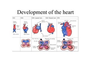 Development of the heart
 