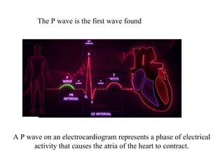 A P wave on an electrocardiogram represents a phase of electrical
activity that causes the atria of the heart to contract.
on the
electrocardiogram
of a healthy
individual.
The P wave is the first wave found
 